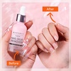image:imageMakartt Nail Glue with Remover Kit Super StrongQuick Dry Nails Adhesive for PressOns 7ML with Press on Nail Glue Remover 30ML Fast Removal Debonder with 2 Droppers DIY Manicure at Home Salon106 Fl Oz Pack of 1